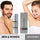 Sydonic hair Removal Treatment