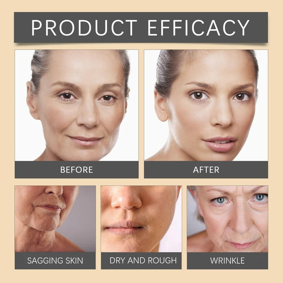 Whitening & Moisturizing Botox Bee Venom Facial Cream