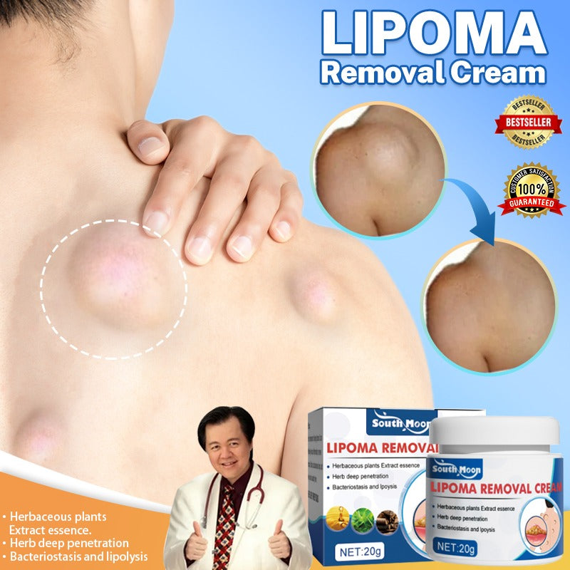 Lipoma Removal Cream | Non-Surgical Lipoma Remover Cream